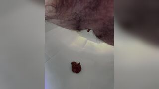 prune diarrhea - video 2, ScatKings.com Scat Porn 9 ScatKings.com Scat Porn